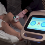 epilacja laserowa bydgoszcz