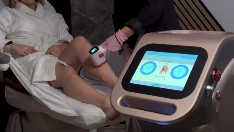 epilacja laserowa bydgoszcz