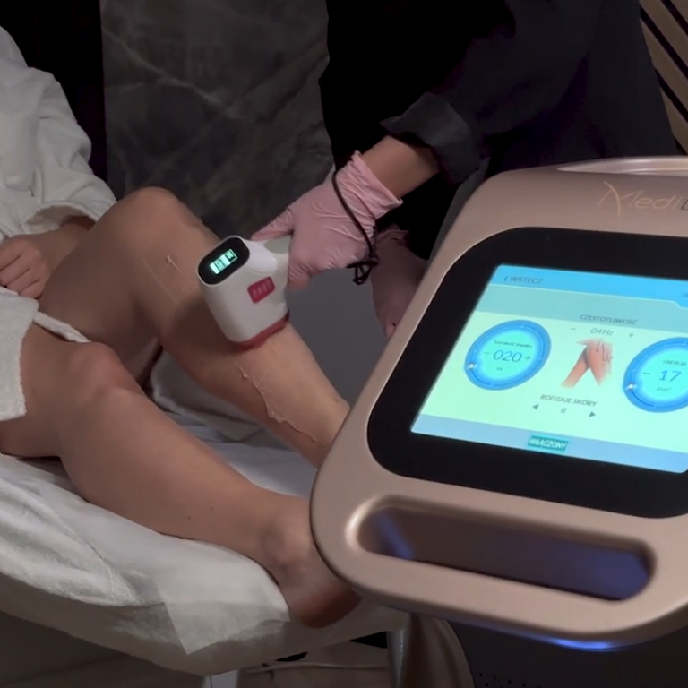 epilacja laserowa bydgoszcz